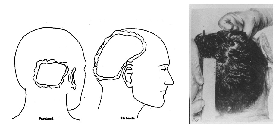 tc96709 Three-views-of-the-head-wound