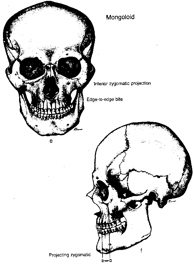 Skullmong