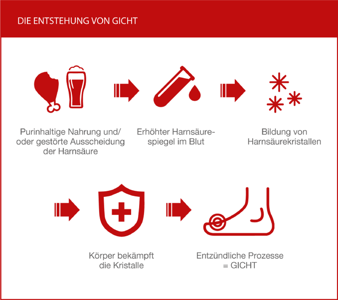 entstehung-von-gicht-schaubild
