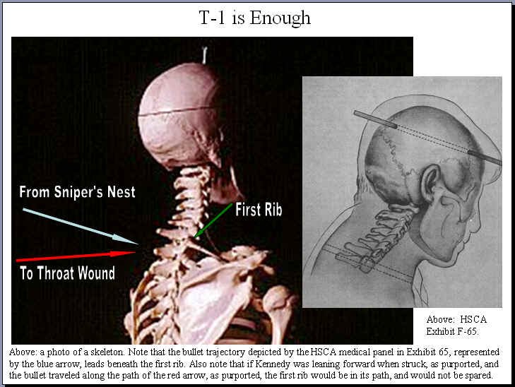 T1is