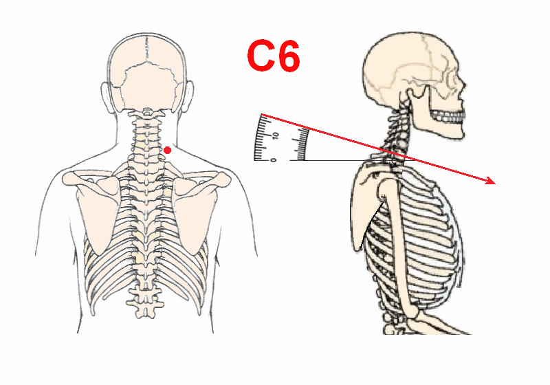 ta9b085b tc8a4e5 tb85cf44d4 t7b95dc SBT