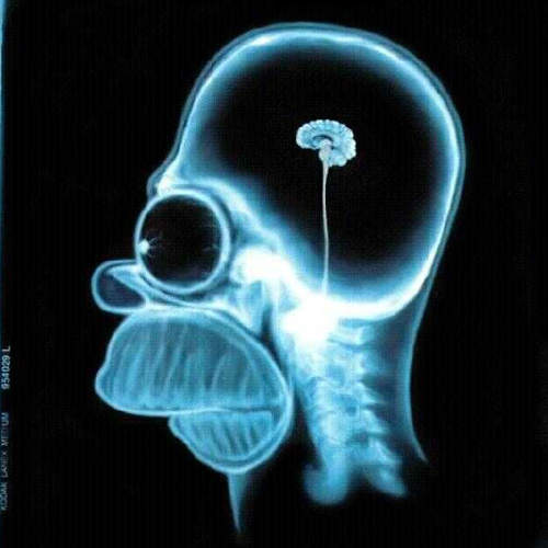 homer simpson xray