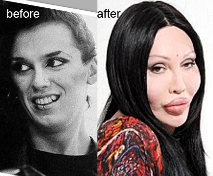 4qaZkT pete-burns-new-face