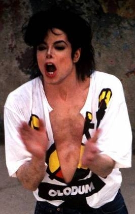 Michael Jackson Vitiligo Chest1