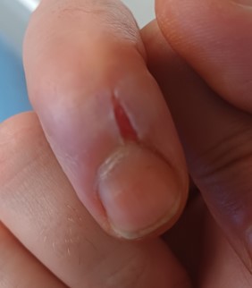 ouch
