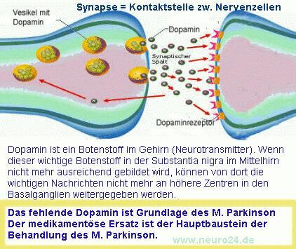 /dateien/gw13703,1116720136,parkinsondopamin