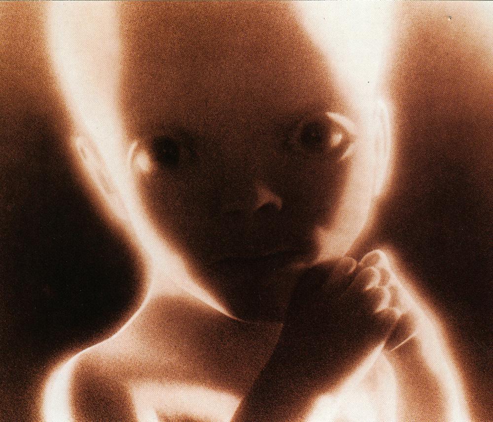 mg57103,1273005915,foetus