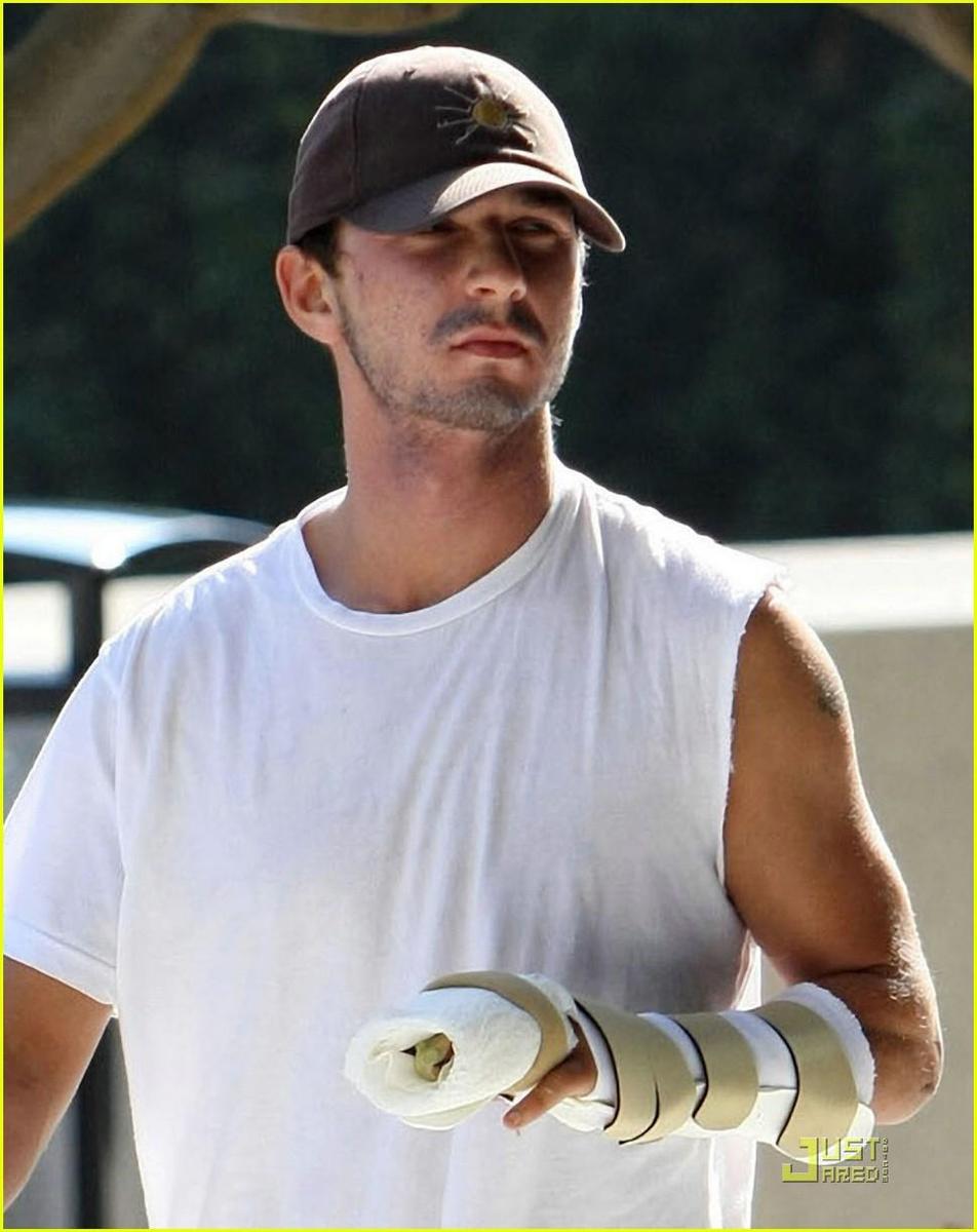 /dateien/np66944,1288632294,shia-labeouf-broken-fingers-01