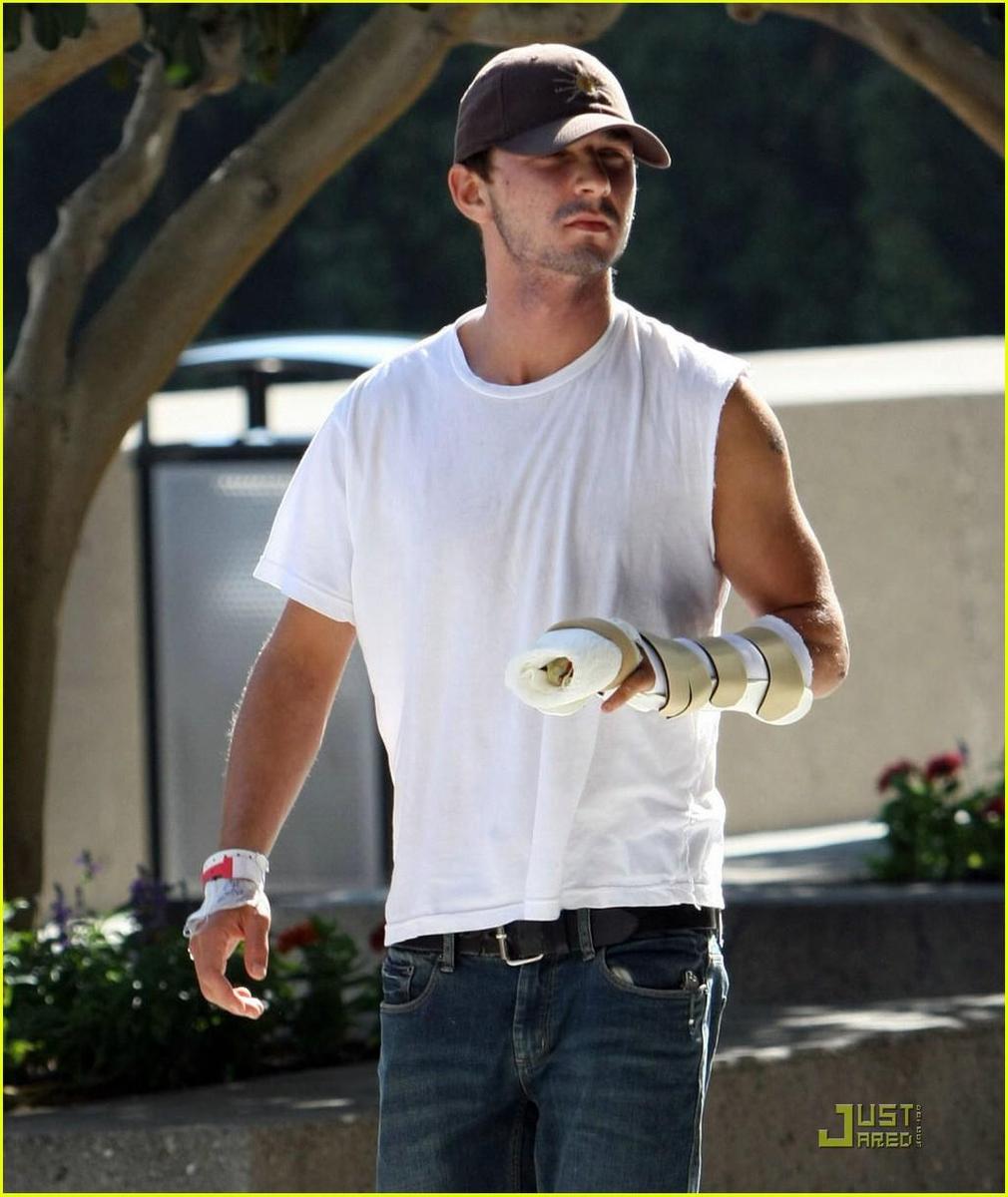 /dateien/np66944,1288632294,shia-labeouf-broken-fingers-05