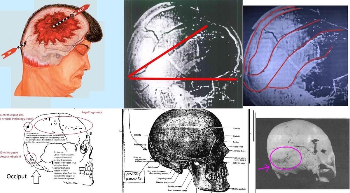 RydbergXray