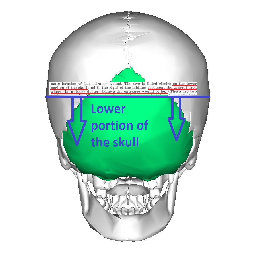 Occipital bone posterior1