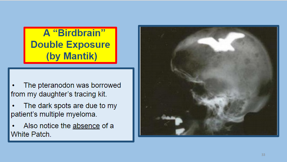 birdbrain