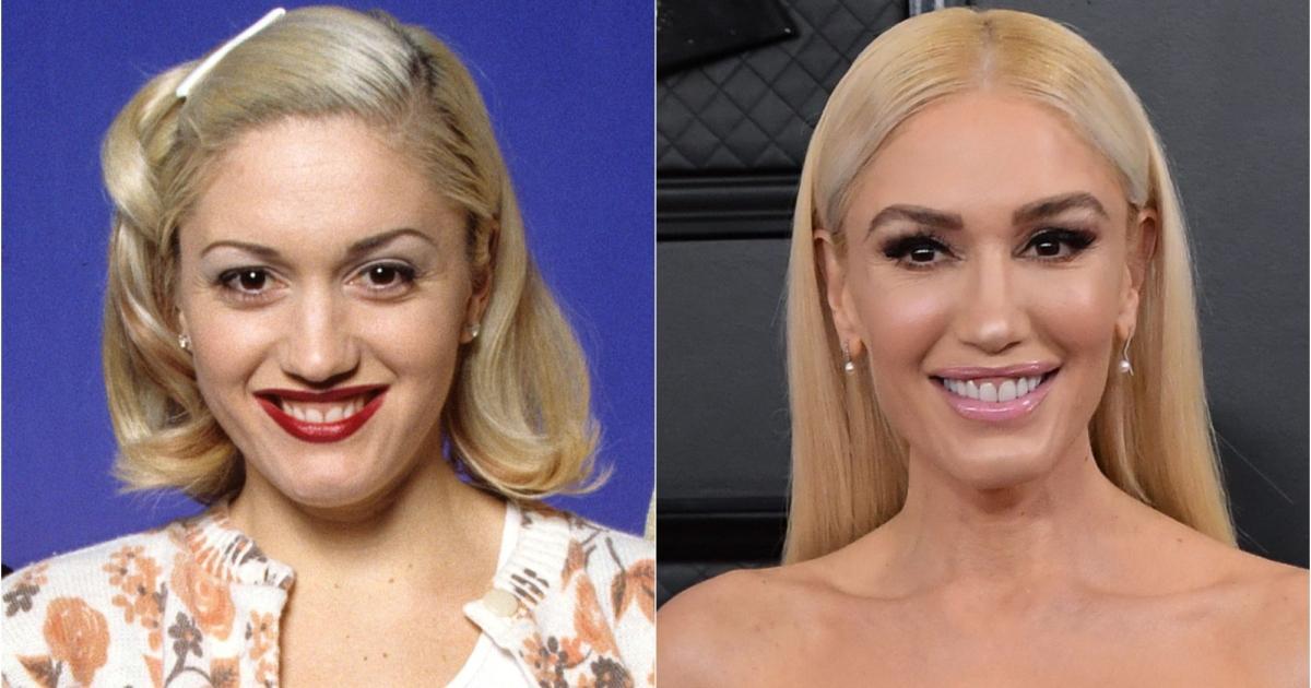 gwen-stefani-before-after-plastic-surger