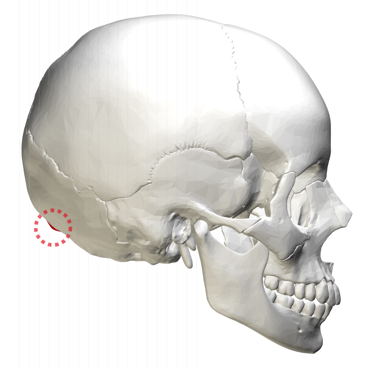 1200px-External occipital protuberance -