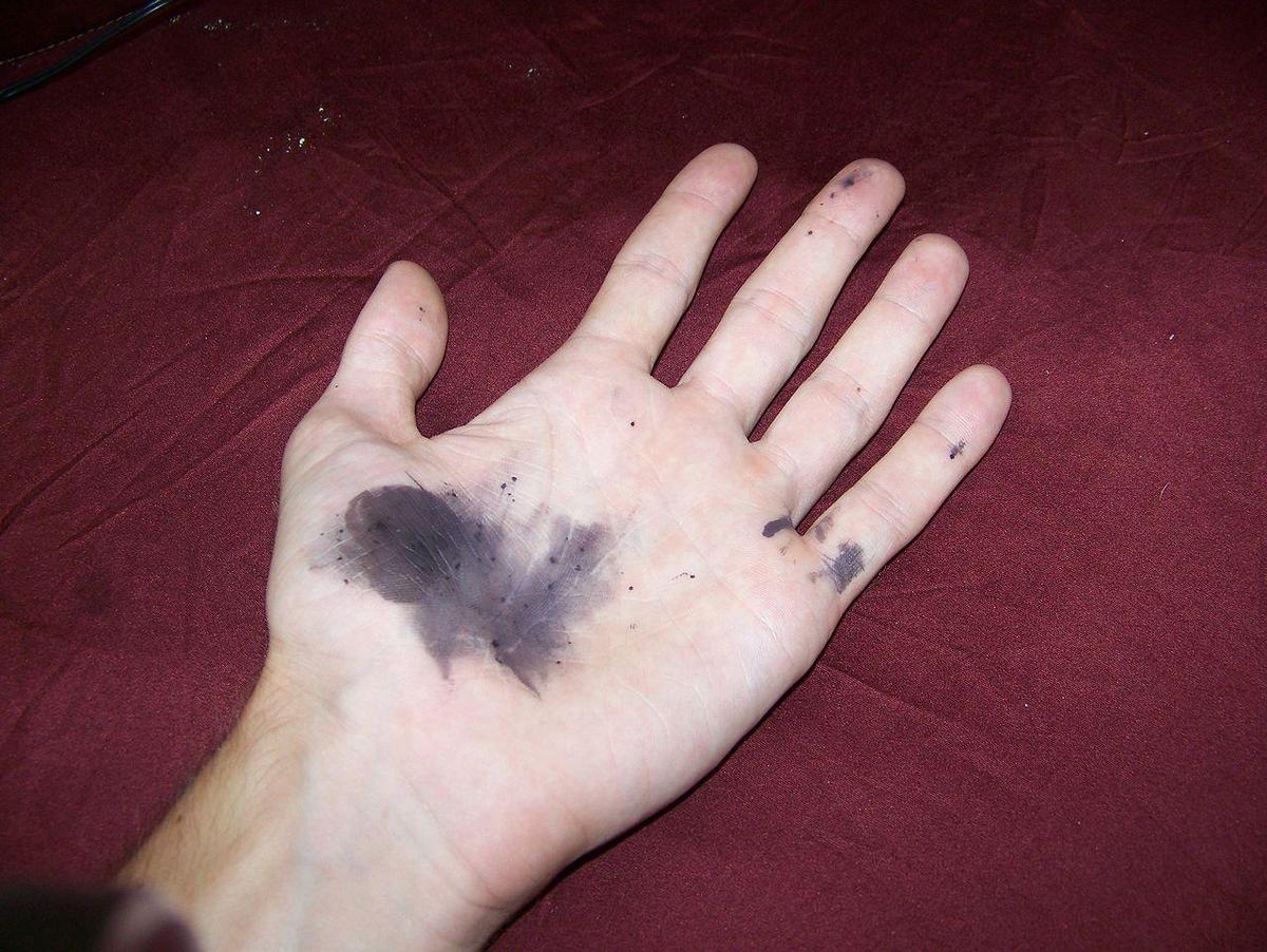 1280px-Silver nitrate stains