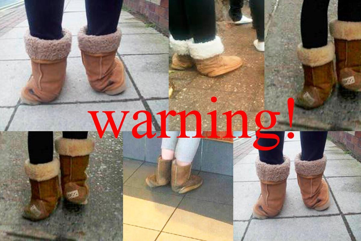 ugg boots gone wrong
