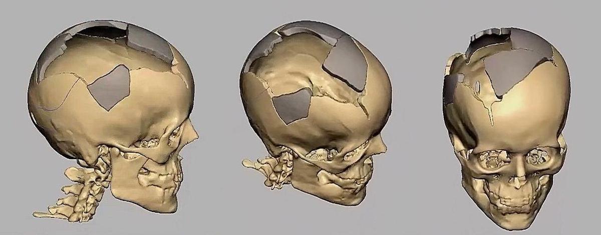 t42e2f3 head3-horz