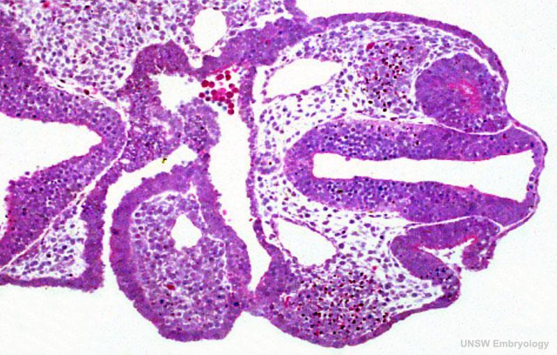 Stage11 histology-optic pit