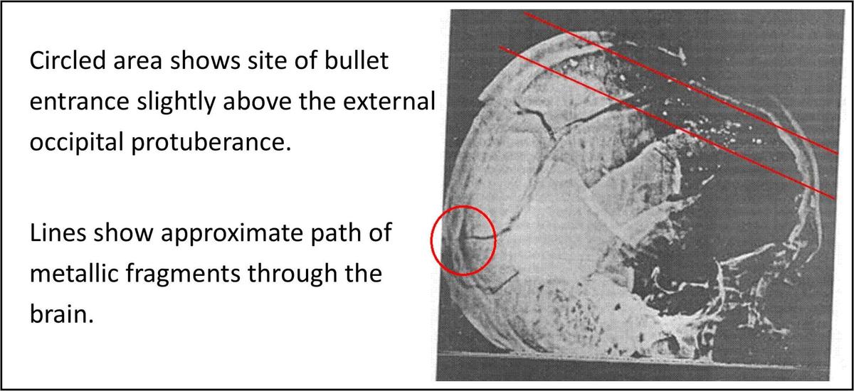 Annotated20X-ray