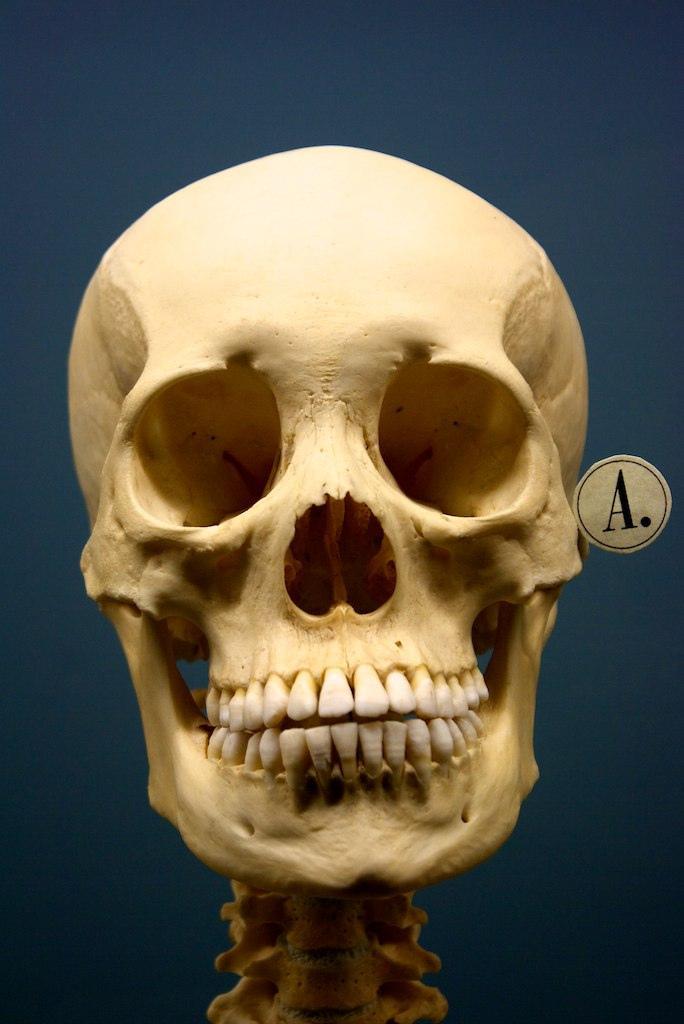 Human skull