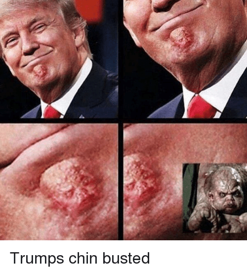 Twitter-Trumps-chin-busted-6b7b5d