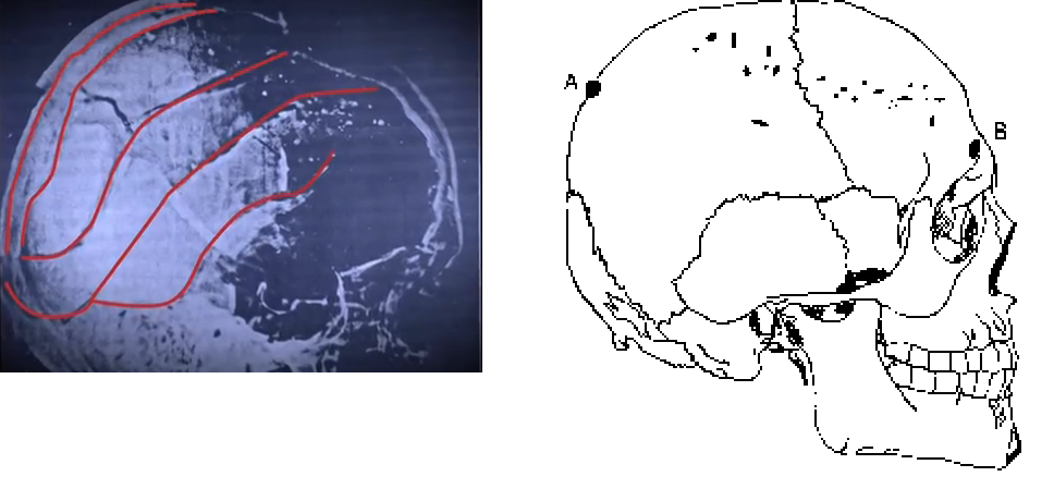 f537bcb2a3270b70 Cold Case Illustratione