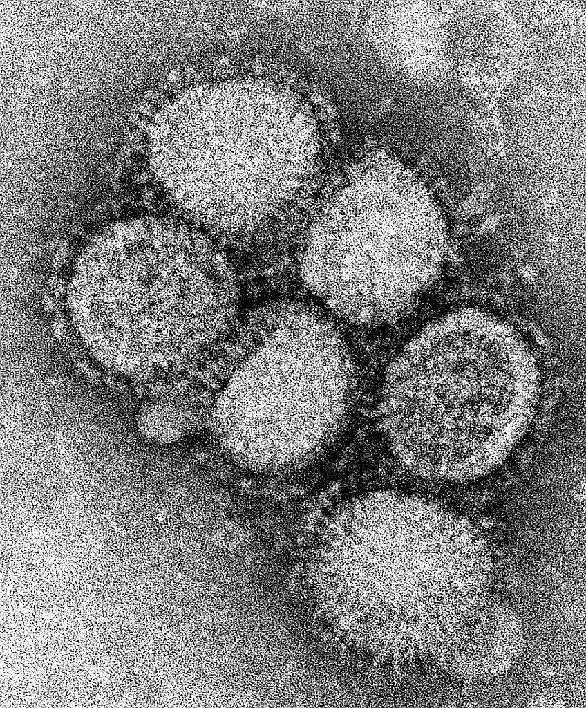 schweinegrippe virus influenza a h1n1