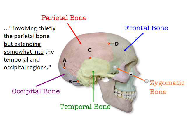 parietal-bone