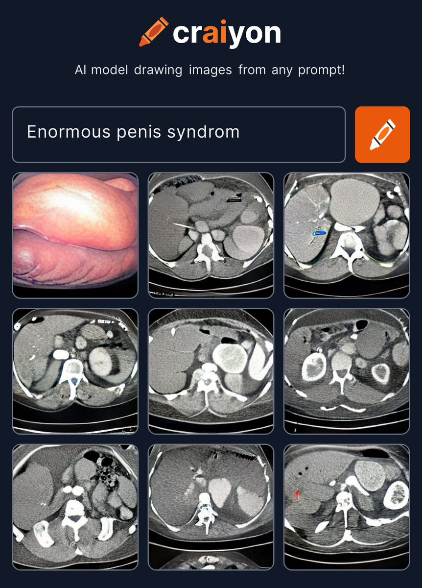 craiyon 145917 Enormous penis syndrom br