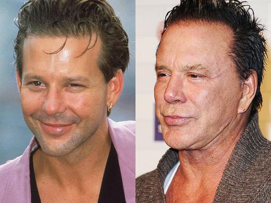 mickey-rourke-beforeafter 540x405