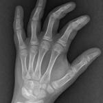 Profil von Triquetrum