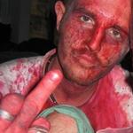Profil von hammelbein