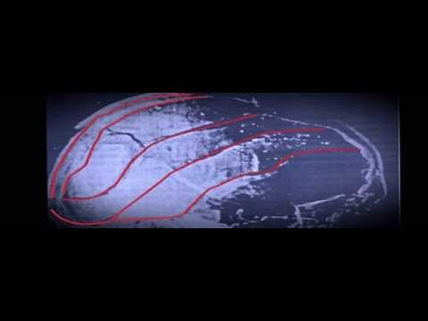 Youtube: JFK Skull Fracture Analysis Cold Case