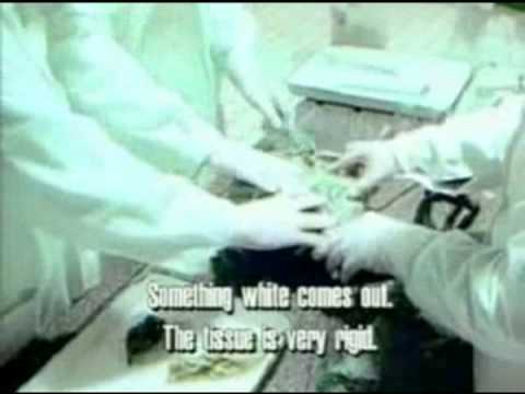 Youtube: Autopsia Alien Ufo Crash Russia 1969