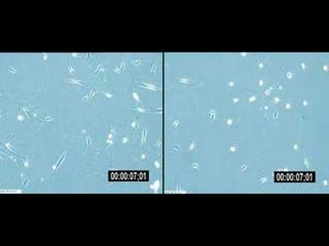 Youtube: THC effects on Tumor Brain Cells, Normal Brain Cells
