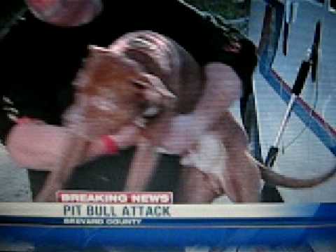 Youtube: Woman attacked by her pit bull