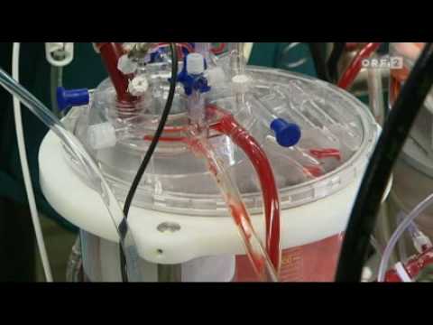 Youtube: ORF 2 - Bluttransfer kann Leben gefährden - Bluttransfusionen