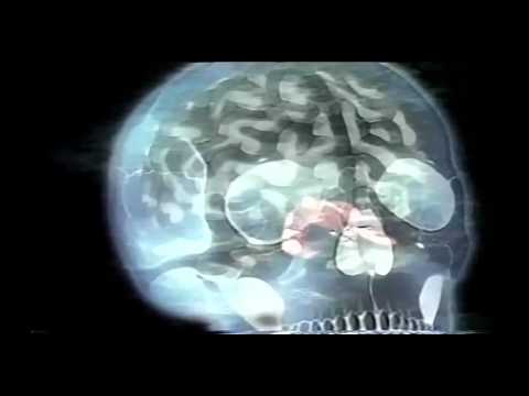 Youtube: Dr. Persinger's God Helmet