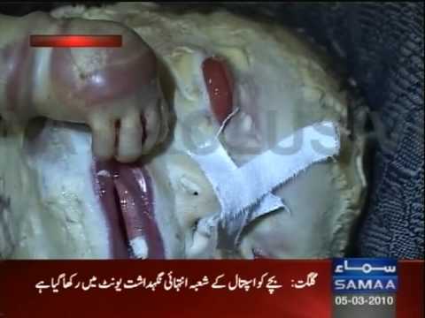 Youtube: Human tiger baby birth in Pakistan.mpg