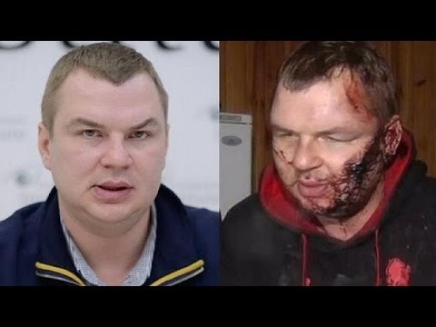 Youtube: Ukraine: Misshandeltem Dmitri Bulatow droht neues Ungemach