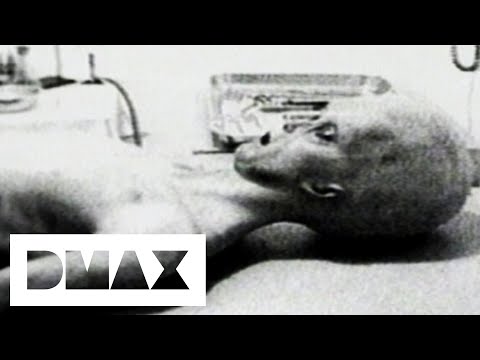 Youtube: Video Footage Of An Alien Autopsy Sheds Light Over UFO Mystery | World's Strangest UFO Stories