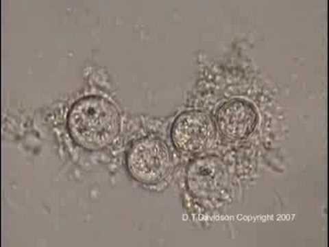 Youtube: Origin, Pregnancy and Birth of unicellular Organism