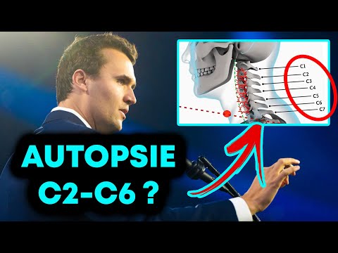 Youtube: Charlie Kirk: Wundballistik – Projektil gefunden? C2–C6 beschädigt?