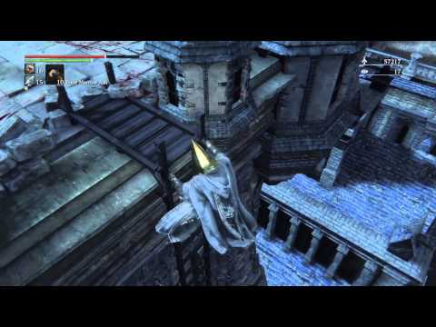 Youtube: Why wearing cone-shaped metal hats is a bad idea.