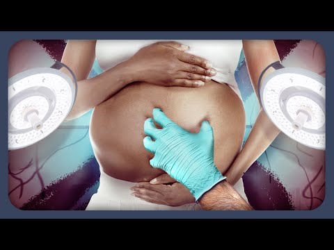 Youtube: Gewalt bei der Geburt: Der unbekannte Skandal | MrWissen2go EXKLUSIV