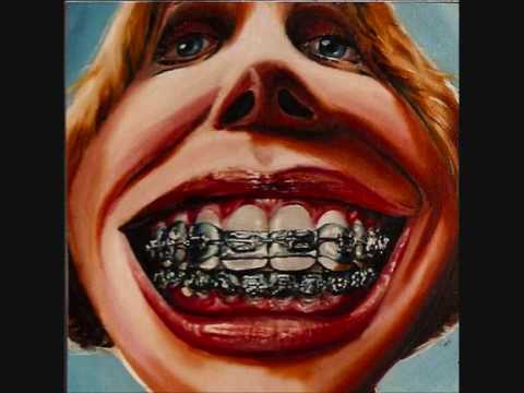 Youtube: Skream- Metal mouth