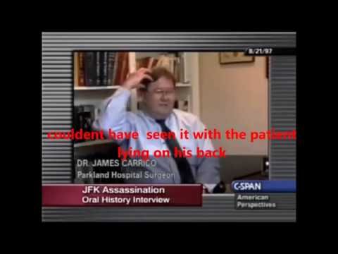 Youtube: JFK parkland doctor explains head wound