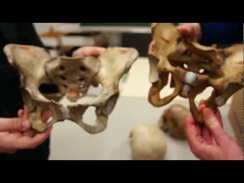 Youtube: Frau oder Mann? Die Hüfte zeigt den Unterschied im Knochenbau