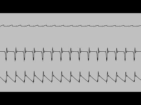 Youtube: COMMODORE C64 SID - 2020 - SOMEWHERE OVER THE RAINBOW - CHRIS-DO / Oscilloscope View