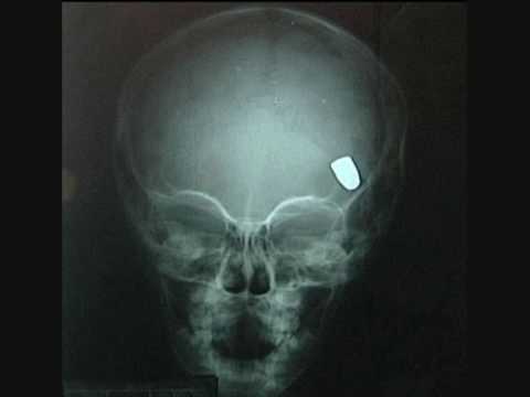 Youtube: orko eloheim feat. odessa kane - bullet inside your brain